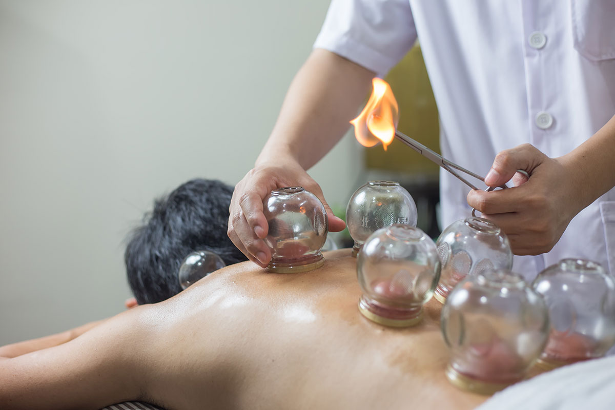 Moxibustion/Cupping/Gua-Sha - Bethel Acupuncture